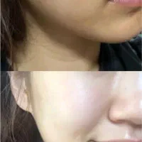 صابون روشن‌کننده و ضدلک قوی (تحویل فوری در اهواز)