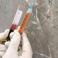 ژل بوتاکس ساکشن غبغب پی ار پی هایفو لیزر لاغری|خدمات آرایشگری و زیبایی|تبریز, |دیوار
