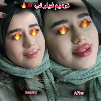 آموزش صفر تاصد پیشرفته ژل و بوتاکس|خدمات آموزشی|اندیمشک, |دیوار
