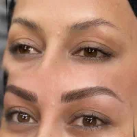 میکروبلیدینگ، شیدلب، کاورتاتوقدیمی ،ریموو ابرو