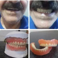 دندانسازی متحرک (مصنوعی)|خدمات آرایشگری و زیبایی|اهواز, شهرک دانشگاه|دیوار