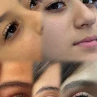کاشت مژه ۵۰٪ تخفیف