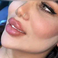 تزریق ژل و چربی و ساکشن وپرسینگ