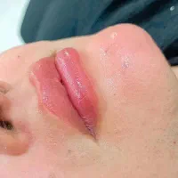 ژل لب خدمات ویژه پاییز تخفیف پاییزی