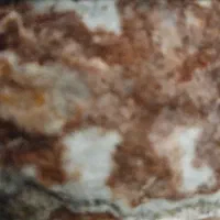 راهنمایی دکترچشم