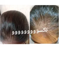 درمان مشکلات بدنی|آرایشی، بهداشتی، درمانی|سیرجان, |دیوار