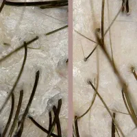 آموزش تخصصی اسکراب اسکالپ مو با ۵۰ درصد تخفیف|خدمات آموزشی|ارومیه, |دیوار