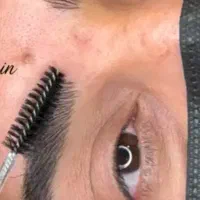 میکروبلیدینگ فیبروز ابرو تخفیف ویژه