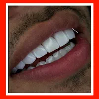 دندانپزشکی/کامپوزیت دندان/ترمیم/روکش/عصبکشی|خدمات آرایشگری و زیبایی|تهران, تهرانپارس شرقی|دیوار