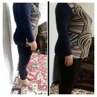 کبدچرب،نازایی،چاقی ولاغری