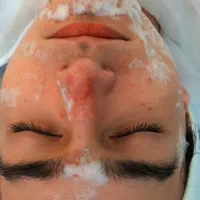 پاکسازی پوست بانوان اطلس مال