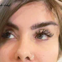 جراحی لیفت شقیقه وابرو ۱۰م بوتاکس ۷۵۰ فول فیس