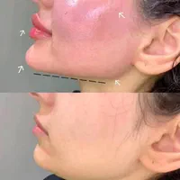 آموزش تزریق ژل و بوتاکس|خدمات آرایشگری و زیبایی|یاسوج, |دیوار