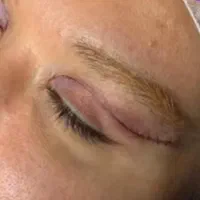 بلفاروپلاستی پلک وسانترال لب 9.360|خدمات آرایشگری و زیبایی|اصفهان, شهشهان|دیوار