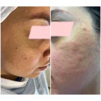 پاکسازی و فیشال تخصصی(بانوان)|خدمات آرایشگری و زیبایی|شاهین‌شهر, حافظ شمالی|دیوار