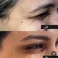 جشنواره ژل و بوتاکس و فیلر بادی(بدن)|خدمات آرایشگری و زیبایی|اصفهان, شهرک کاوه|دیوار