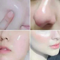 کرم معجزه vip سفید کننده و ضدلک صورت و بدن
