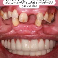 زیبایی دندان و ترمیم و درمان تخصصی|خدمات آرایشگری و زیبایی|ملارد, |دیوار