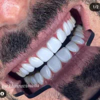 پذیرش دندانپزشکی