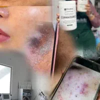 تخفیف ویژه فشیال تخصصی عیدقربان