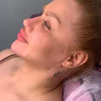 تزریق ژل ( فیلر ) بوتاکس مزو نخ کانتورینگ عربی|خدمات آرایشگری و زیبایی|تهران, صادقیه|دیوار