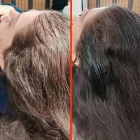 با تکنیک میکرواسکالپ،کم پشتی مو دیگه دیده نمیشه|خدمات آرایشگری و زیبایی|شاهین‌شهر, فردوسی|دیوار