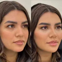 تخفیف کلینیک ژل بوتاکس نخ|خدمات آرایشگری و زیبایی|یاسوج, |دیوار