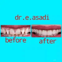 دندانپزشکی و زیبایی لبخند، تعرفه دولتی