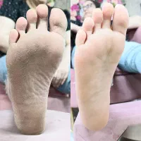 کفسابی پا،رفع ترک ،خشکی پا/تخفیف ویژه فصل