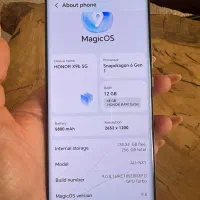 آنر X9b با حافظهٔ ۲۵۶ گیگابایت|موبایل|تهران, مشیریه|دیوار