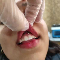 چال گونه /آموزش و خدمات پیرسینگ تخصصی|خدمات آرایشگری و زیبایی|بندرعباس, |دیوار