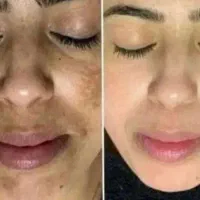 مشاوره درمانی رایگان|فعالیت داوطلبانه|کرمانشاه, |دیوار