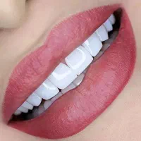 جشنواره کامپوزیت لمینت ، روکش|خدمات آرایشگری و زیبایی|تهران, دردشت|دیوار