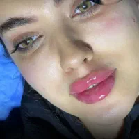 لیزر ونوس با دستگاه Soprano ICE Platinum|خدمات آرایشگری و زیبایی|تبریز, |دیوار