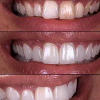 خدمات دندانپزشکی|خدمات آرایشگری و زیبایی|رشت, گلسار|دیوار