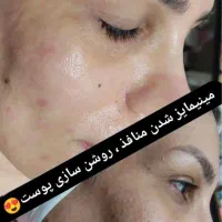 پاکسازی صورت/پدیکورپا/پارافین(اموزش هم داده میشود)|خدمات آرایشگری و زیبایی|اهواز, کوی علوی|دیوار