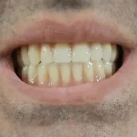 دندانسازی (ساخت دندان مصنوعی تعمیر دندان مصنوعی )|خدمات آرایشگری و زیبایی|تهران, مشیریه|دیوار