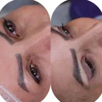 صورتتو دوباره شاداب کن