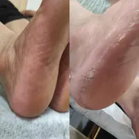 آموزش پروتئین کراتین بافتموپدیکور کفسابی کاشت ناخن