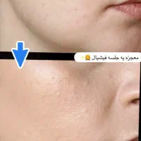 آفر پاکسازی صورت|خدمات آرایشگری و زیبایی|مشهد, ادیب نیشابوری (شهرک غرب)|دیوار