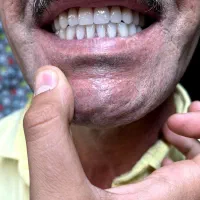 دست دندان مصنوعی و پروتز متحرک|خدمات آرایشگری و زیبایی|اصفهان, شهرک کاوه|دیوار