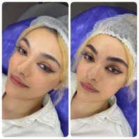 مدل رایگان  میکروبلیدینگ و شیدینگ لب