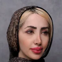 لیفت صورت بینی و غبغب تکنیک اروپایی بدون جراحی|خدمات آرایشگری و زیبایی|مشهد, کوثر|دیوار