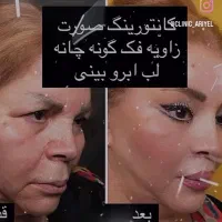 کلیه خدمات زیبایی در مطب دکتر شکری انجام میشود