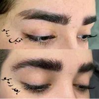 خدمات رایگان ریموو