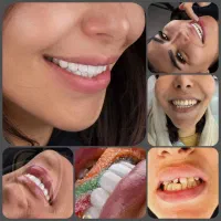 دندانپزشکی دیجیتال نقدواقساط بدون کارمزدبا۲۰%تخفیف|خدمات آرایشگری و زیبایی|مشهد, سناباد|دیوار
