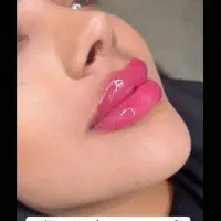 ژل بوتاکس چال لپ فیلربیکینی مزوتراپی پیرسینگ|خدمات آرایشگری و زیبایی|اسلام‌شهر, زرافشان|دیوار