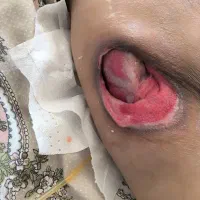 درمان تخصصی انواع زخم با روش‌های نوین و روز دنیا|خدمات آرایشگری و زیبایی|اهواز, کیانپارس |دیوار