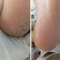 پدیکور و کفسابی پا