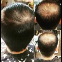 تونیک خارق‌العاده